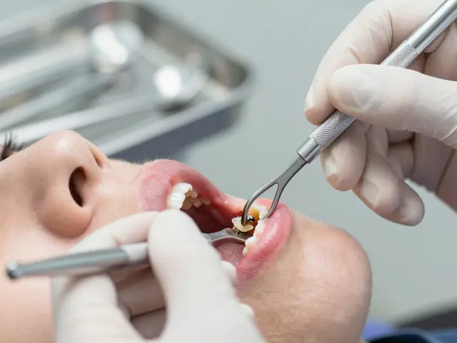 Co říkají zubní lékaři o kyretáži zubů? Pravda o léčbě parodontitidy