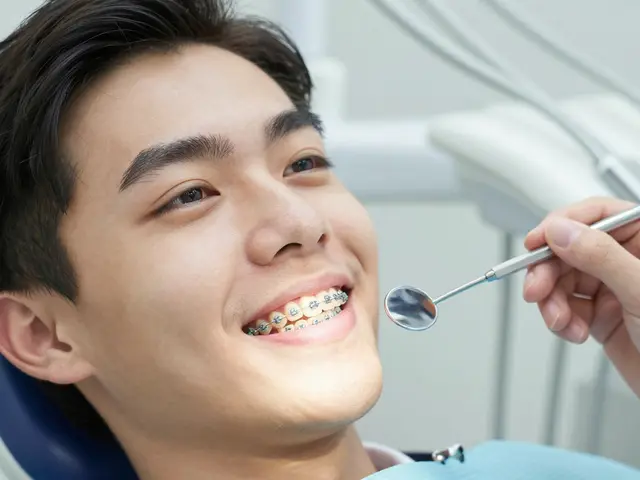 Jak dlouho se nosí rovnátka na přední zuby - průměrná doba a co ovlivňuje délku léčby