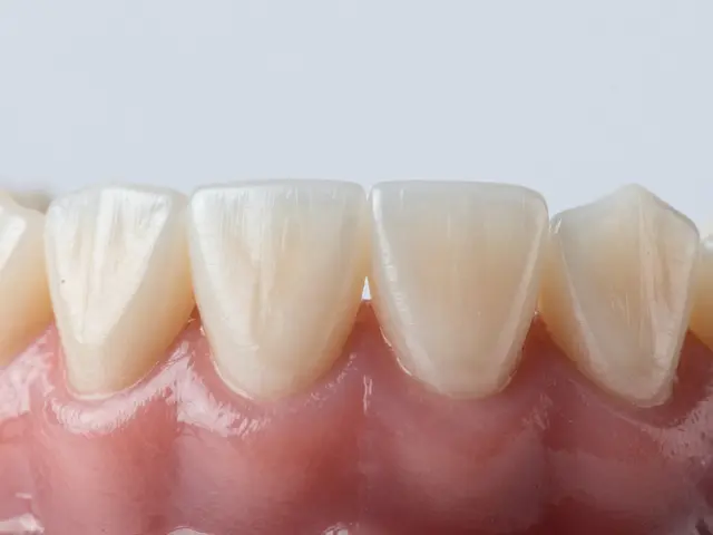 Fazety na křivé zuby: Fungují jako alternativa k rovnacím?