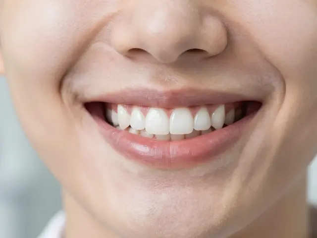 Kompozitní fazety cena: Kolik stojí úsměv z kompozitu v roce 2026?