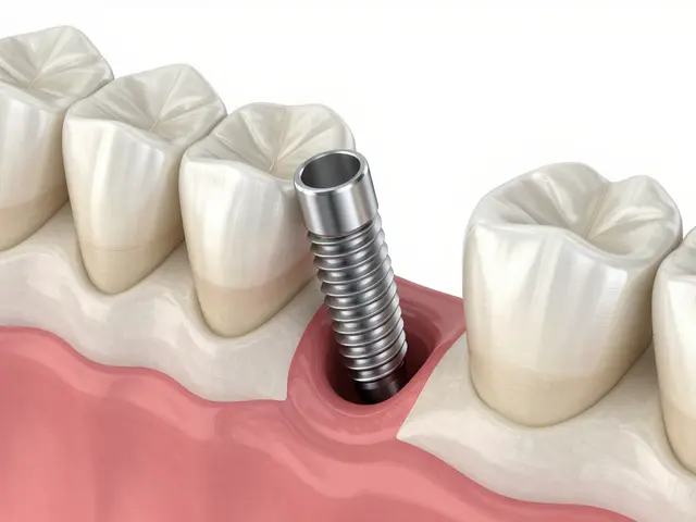 Zubní implantáty: Kompletní průvodce cenami, typy a péčí v roce 2026